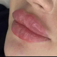 جشنواره فیلر نورامیس و متد ام برای لب
