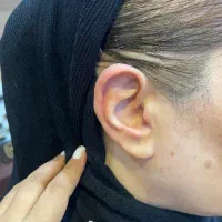 فروش سمعک  در کلینیک معتبرشنوایی