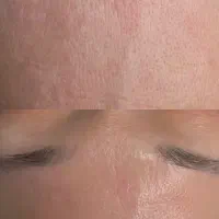 خدمات پاکسازی پوست و فیشیال تخصصی با %10تخفیف محرم