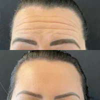 بهترین خدمات زیبایی ژل بوتاکس فیلر مزوژل لیزر|خدمات زیبایی و سلامت|شیراز, ارم|دیوار