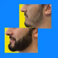 توی.یک.ماه.پرپشتش کن