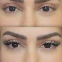 مژه