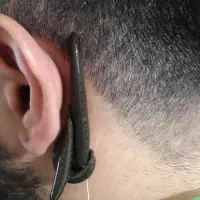 حجامت،فصدخون،زالو درمانی،طب سنتی،پی آر پی|خدمات آرایشگری و زیبایی|تهران, تهرانسر شمالی|دیوار