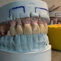 نیازمند کارآموز دندانسازی