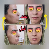 فیلر،بوتاکس،ومزوتراپی و..  اقساطی