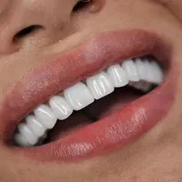 خدمات دندانپزشکی با قیمت مناسب