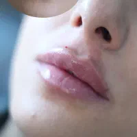 ورکشاپ آموزشی تزریق فیلر و بوتاکس