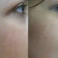کرم صورت