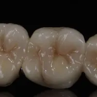 پودرگذار و کارآموز مسلط به قالبریزی درلابراتوار|استخدام درمانی، زیبایی، بهداشتی|تبریز, |دیوار
