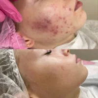مدل فیشیالcip با دستگاه آنالیز دار و هوش مصنوعی