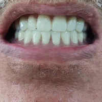 دندانسازی (ساخت دندان مصنوعی تعمیر دندان مصنوعی )