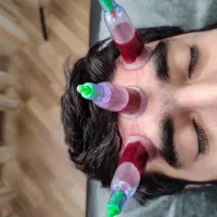 حجامت  طب سوزنی   زالو درمانی
