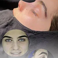عمل بینی