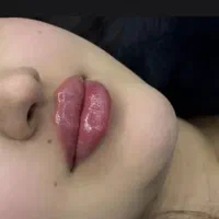 تزریق فیلرلب به سبک نچرال850/انزیم600 /پیرسینگ250