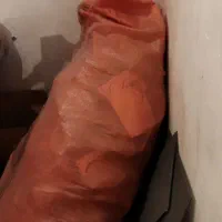 اسکاچ