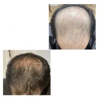 با این کله روت میشه از خونه بیای بیرون
