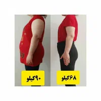 چاقی لاغری کبدچرب  چاقی صورت پوست مو و...