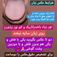 بیاببین توبدنت چه خبره