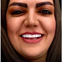 دندانپزشکی/کامپوزیت دندان/ریمو/تخصصی