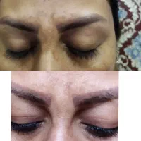 چه چیزی روی پوست صورتت اذیتت میکنه