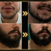 اقدام از تو‌ پرپشتیش از ما