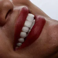 شرایط پرداختی آسان دندانپزشکی،زیبایی،ایمپلنت