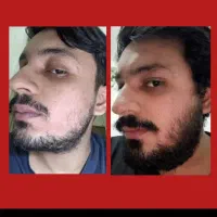 زیر ۳هفته. اصولی پر.پشتش. کنن