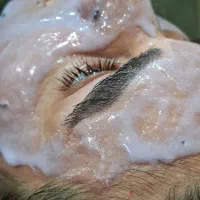 پاکسازی پوست و تخلیه ملیاو شیدینگ لب