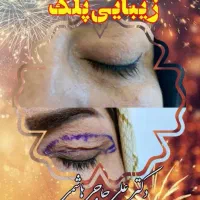 عمل پلک بالا و پائین توسط پزشک فوق تخصص