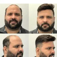خدمات پروتز مو و اصلاح vip اقایان
