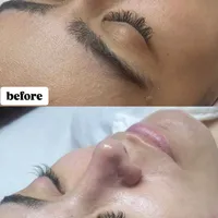 پاکسازی و فیشال درمانی پوست|خدمات آرایشگری و زیبایی|تهران, نظام‌آباد|دیوار