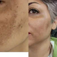 جشنواره ویژه اموزش فیشیال و پاکسازی