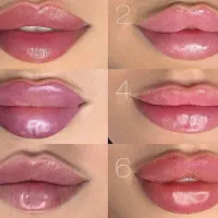 تزریق ژل فیلر و بوتاکس صورت و بدن تضمینی
