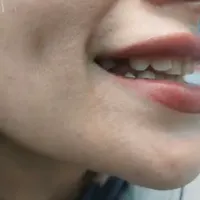 ساخت انواع دندان مصنوعی + لابراتوار دندانساری|خدمات آرایشگری و زیبایی|تهران, یافت‌آباد|دیوار
