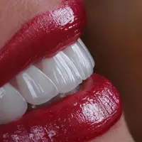 دندانپزشکی اقساطی  عصب کشی . کامپوزیت و...|خدمات آرایشگری و زیبایی|قم, عمار یاسر|دیوار