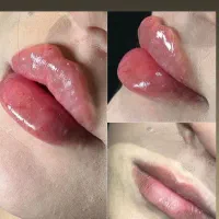 بلفارو بوتاکس کاشت ابرو مو میکرو تتو چالگونه فیلر