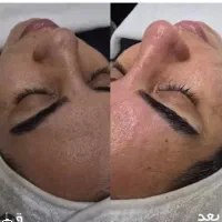 جشنواره تابستانه فیشال(پاکسازی پوست)