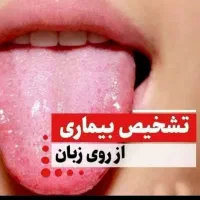 باسونوگرافی زبان از تمامی‌مشکلات و بیماریت آگاه شو