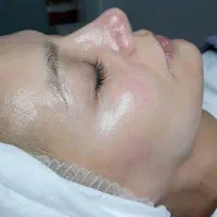 آموزش فیشال و پاکسازی پوست پیشرفته
