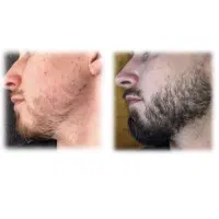 ریش و مو ابرو سبیل