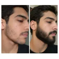 مردای خوشتیپ ریش دارن