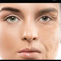 کرم لیفتینگ  معجزه گر