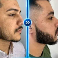 بیا مثل جنگل پر باش