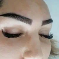 کاشت مو ،ابرو وریش
