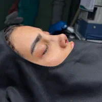 جراحی زیبایی