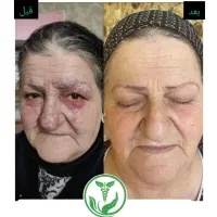 مشاوره بیماری های پوستی