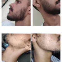 خوشگلی تو از من بخواه /ریش جذاب