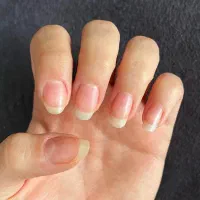 تقویت و سلامت ناخن و پوست دست
