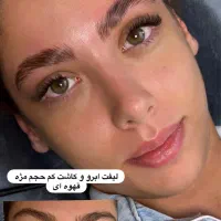 تخفیف ویژه فیشال پوست،لیفت واکستنشن مژه