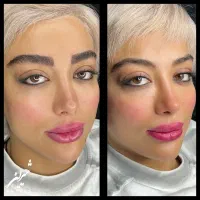 میکروبلیدینگ و شیدینگ لب با قیمت استثنائی